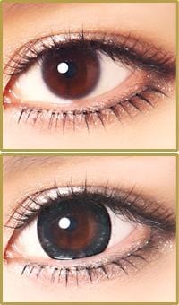 Geo Medical Geo Starmish Black