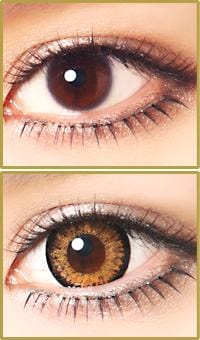 Geo Medical Geo Starmish Brown