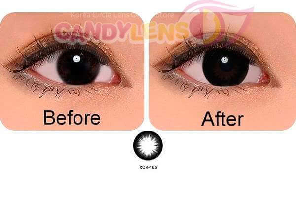 Geo Medical Geo Ultra CK105 (XCK-105)